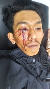 mbminvestigasi.com | PBH FERADI WPI Pimpinan Benni Rusli mendesak Polsek Soreang Menangkap Pelaku Penganiaan Dendi Sumianto